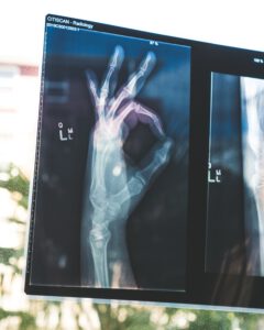 Medizinische Behandlungsfehler Medizinische Behandlungsfehler - Was kann man machen?